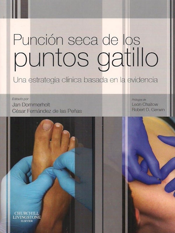 Puncion Seca De Los Puntos Gatillo en Sanatendencia