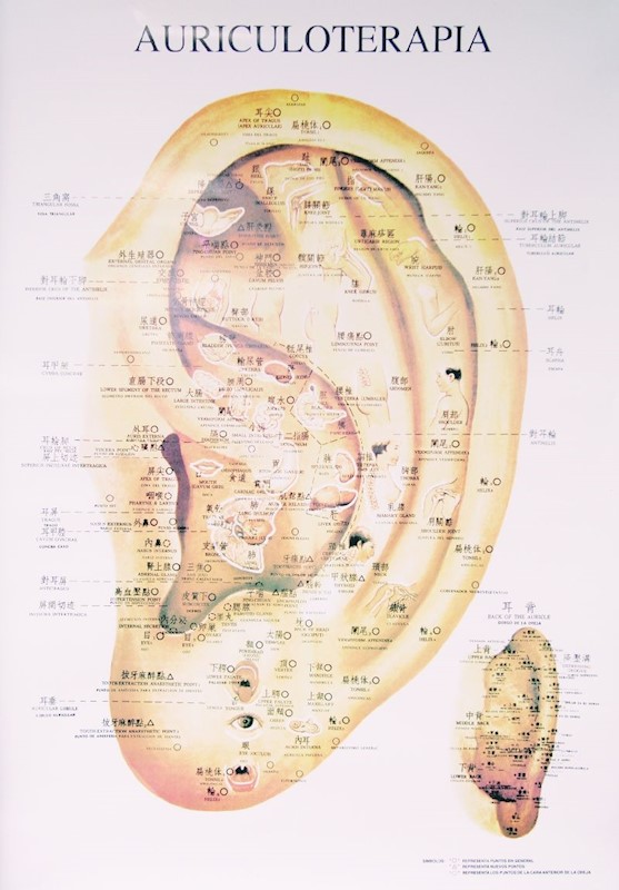 Topografia Auricular